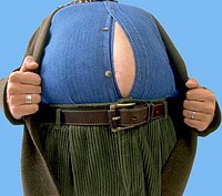 obezita 2